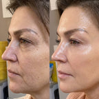 MENDING PDRN Pink Glow Serum